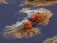 Google's AR can see cancer